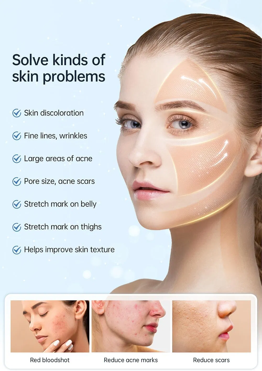 Nieuwe Hydra Pen H5 Infusiedrager Serum EMS en Microneedling Automatische Toepassing 4