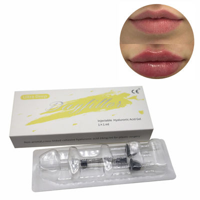 Hyaluronzuur Dermale vulmiddel Cross Linked Sodium Hyaluronate 1 ml 2 ml 5 ml