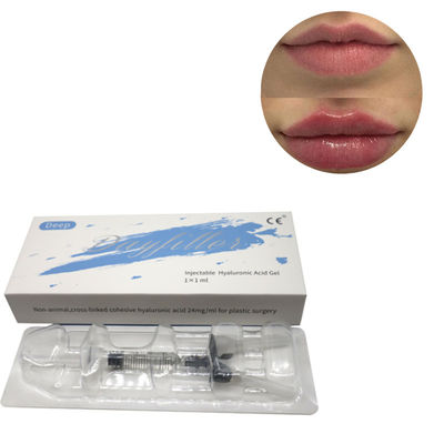Nieuwe diepe hyaluronzuur huid vuller kruisverbinding 2 ml 5 ml kruisverband