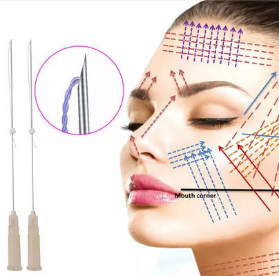 PDO oplosbare draadlift voor het liften van nek en wangen